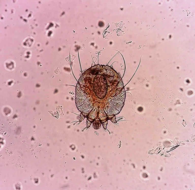 Sarcoptes scabiei - imagem ilustrativa